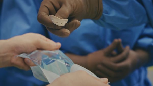 Innovationsmeilenstein am Universitätsspital Basel: Erstes 3D-gedrucktes patientenspezifisches Kinn-Implantat erfolgreich eingesetzt